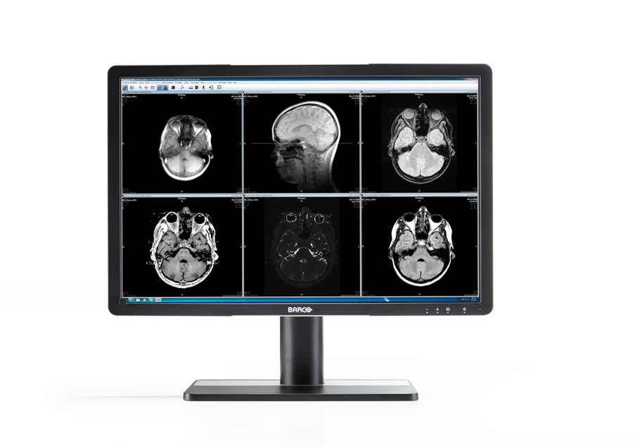 Barco MDRC-2222 TS
