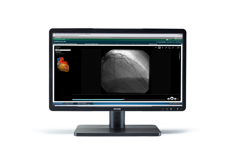 Barco MDRC-2222 BL